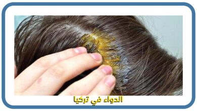 صورة فوائد الثوم للعناية بالشعر