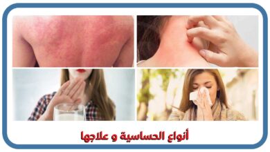 صورة ما هي الحساسية؟